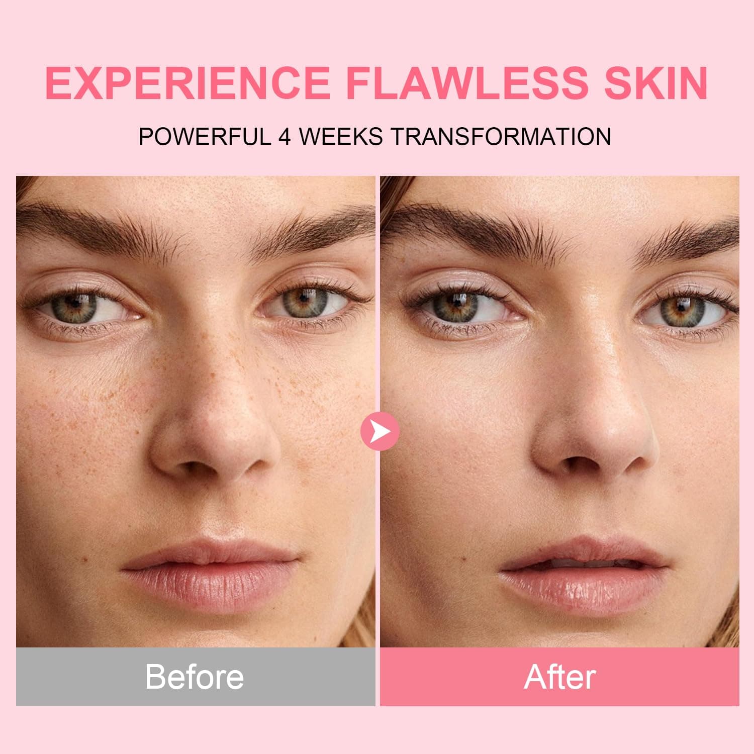 AVJONE PDRN Serum for Face – with 10% Niacinamide & Collagen, Advanced Salmon PDRN Serum for Uneven Skin, Hydration & Elasticity, Glass Skin, Fragrance Free 30ml,1.01 Fl Oz, view 6